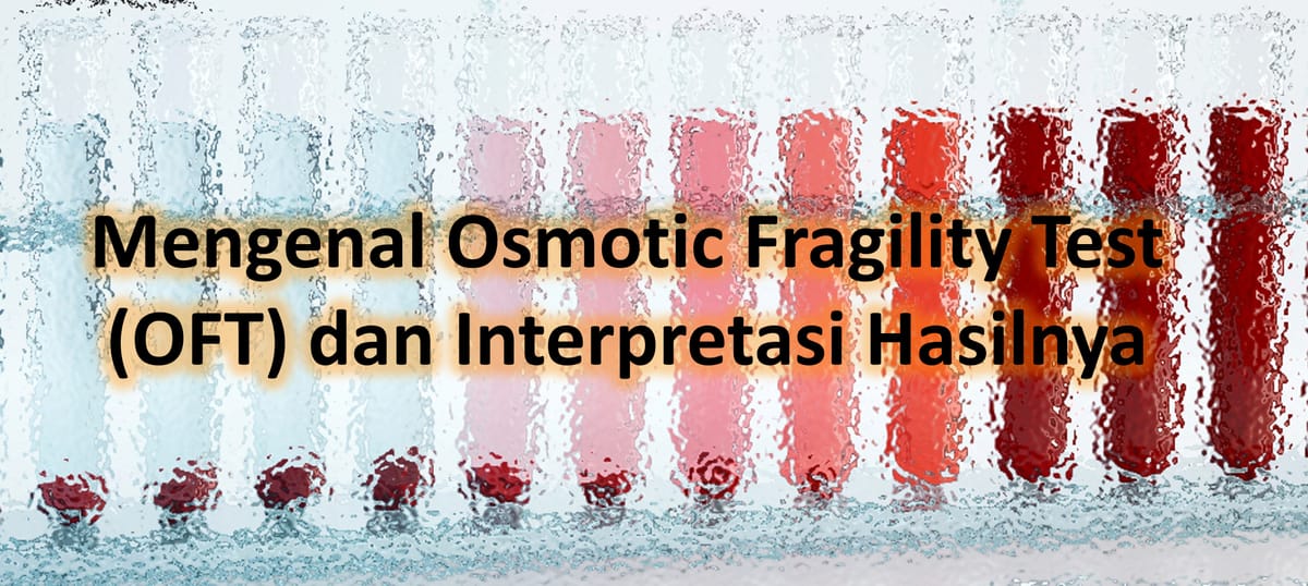 Mengenal Osmotic Fragility Test (OFT) dan Interpretasi Hasilnya