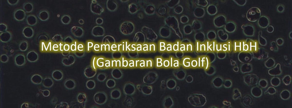Metode Pemeriksaan Badan Inklusi HbH (Gambaran Bola Golf)