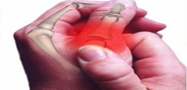 Kriteria Diagnostik (Lab) Rheumatoid Arthritis