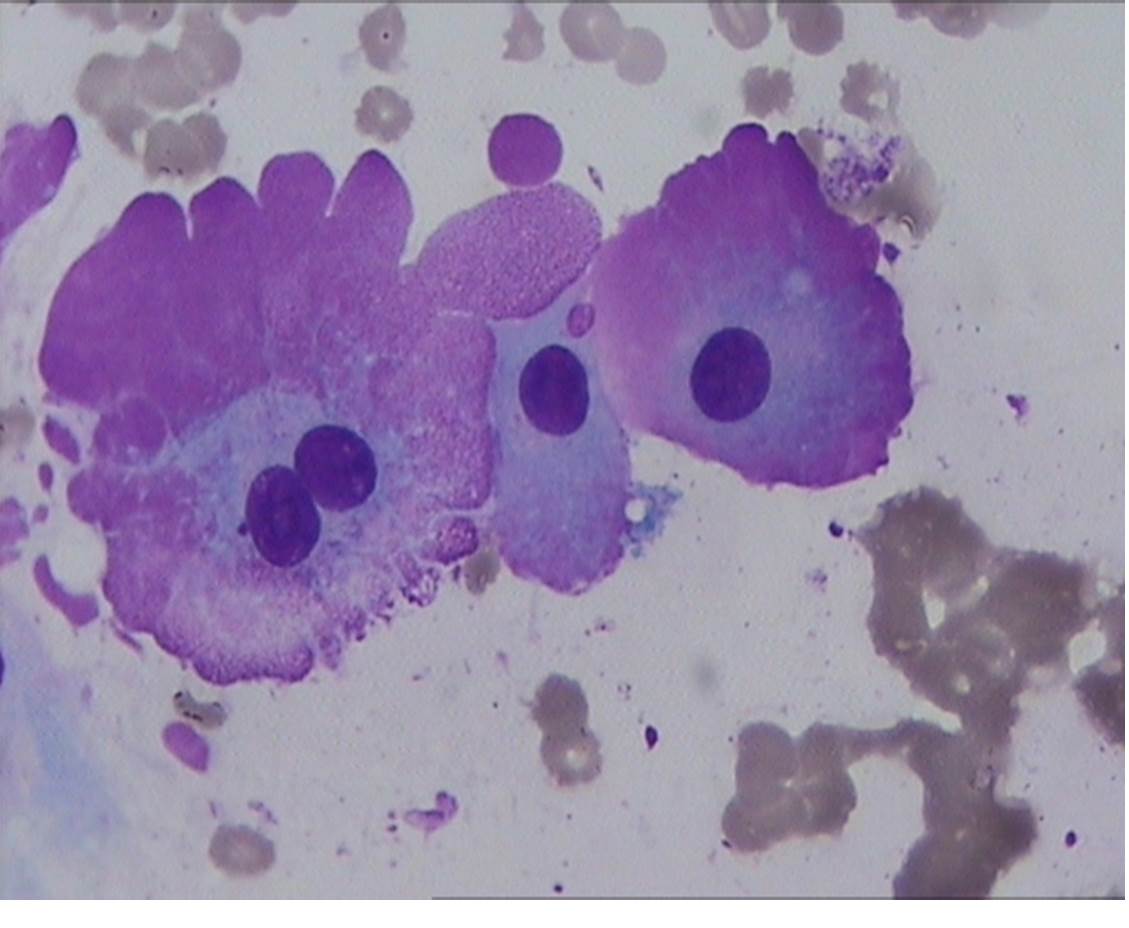 Flame cell