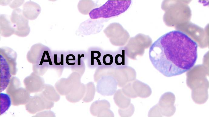 Auer Rod